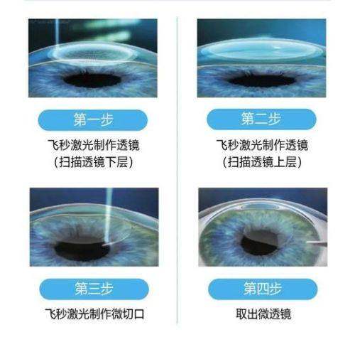 西安灞桥区人民医院眼科