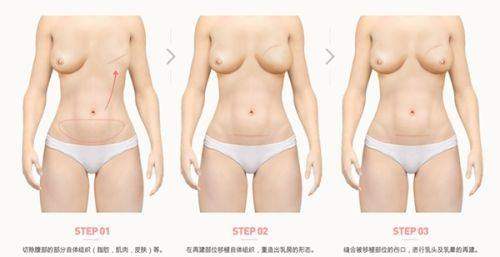 哈尔滨长峰血管瘤医院地址电话营业时间