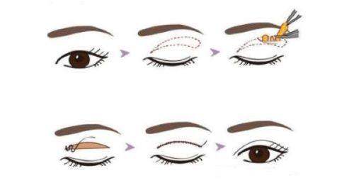 珠海美涵医疗美容门诊部地址电话营业时间