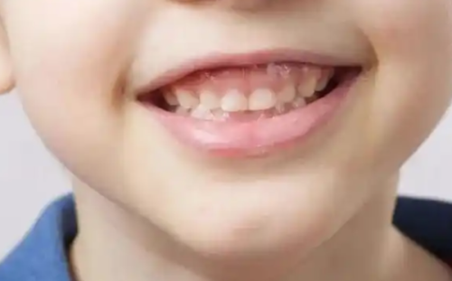 卢军胜医生口碑评价及真人实例