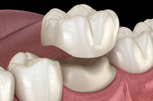 刘浩医生技术优势