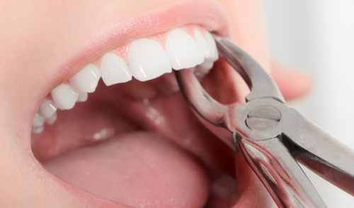 乳山小海豚口腔详细的预约挂号方式及流程