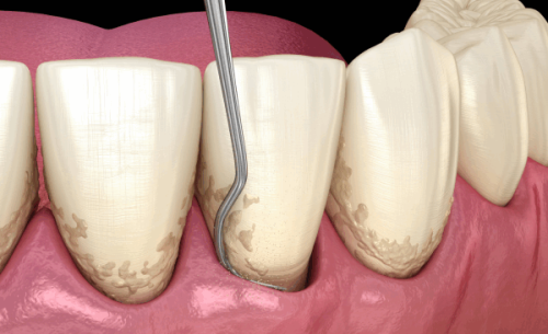 牛言海医生价格表