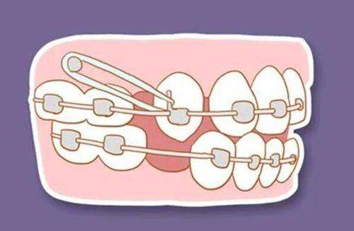 河南南阳方城万超口腔诊所张草医生诊疗项目介绍