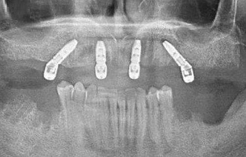牛言海医生擅长项目