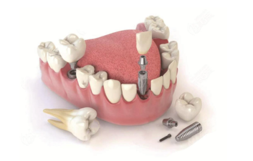 深圳正夫口腔医院（水贝IBC店）特色项目及技术优势