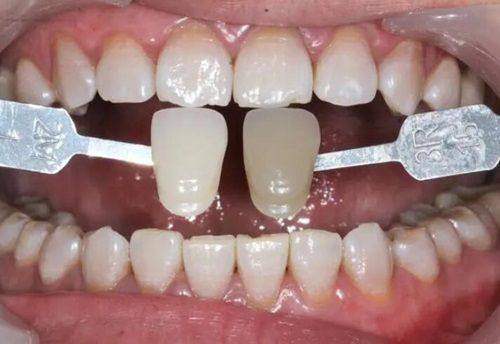 卢军胜医生预约挂号