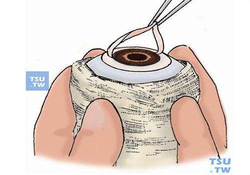 刘巨平医生预约挂号