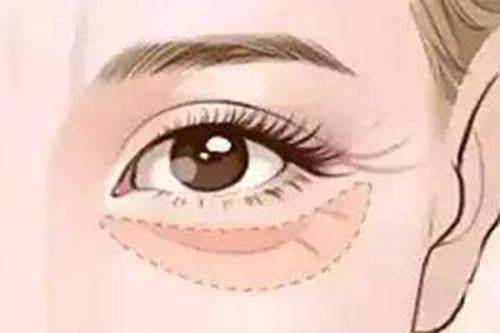 张文娴医生技术优势