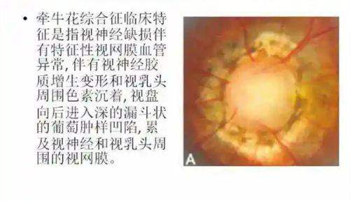 文呈呈医生擅长项目