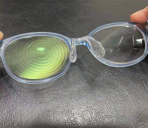 文呈呈医生技术优势