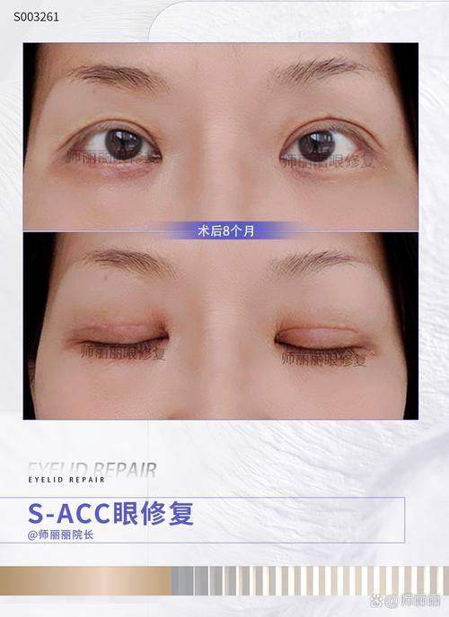 西双版纳艾美莎医疗美容诊所真人口碑评价怎么样？