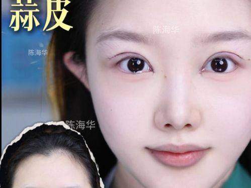 Retmus整形外科诊所收费价格表/收费标准