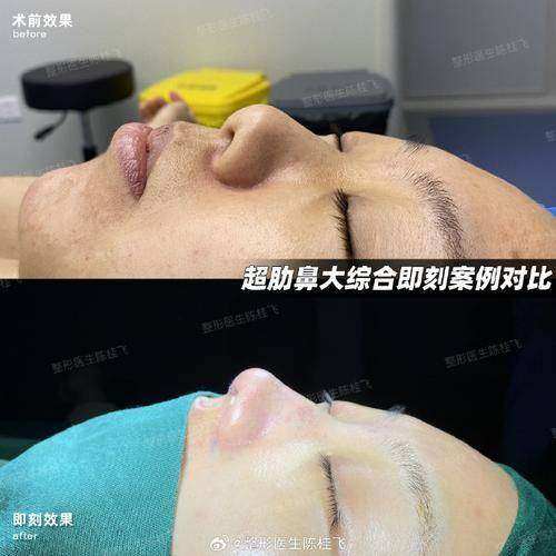 西安大爱医院医美科是正规医院吗?