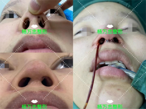 西安大爱医院医美科特色项目及技术优势