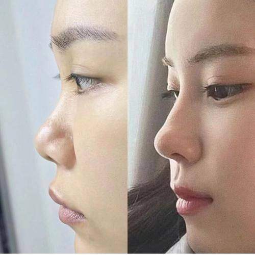 Retmus整形外科诊所详细的预约挂号方式及流程