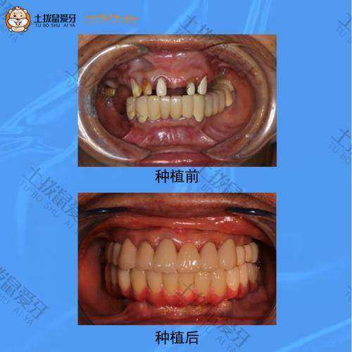 深圳正夫口腔医院（水贝IBC店）地址电话营业时间