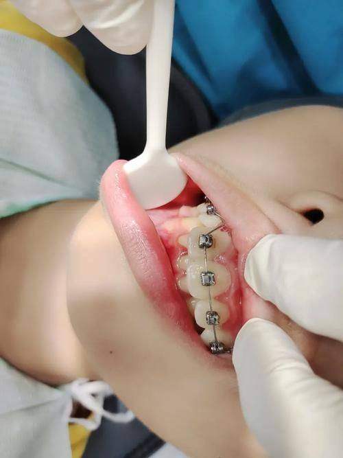 八、郑海鹏医生口腔费用一览表：