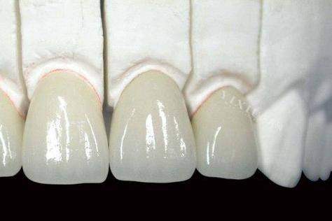 昆山亭林口腔门诊部特色项目及技术优势