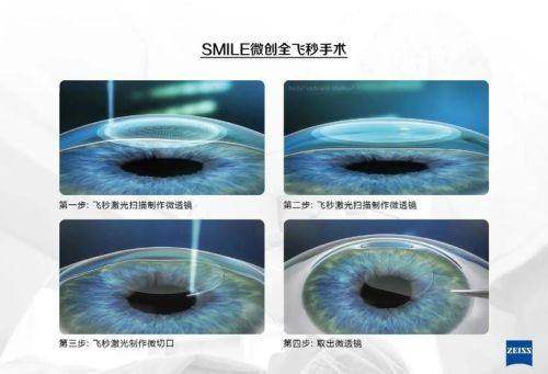 东营区人民医院眼科真人口碑评价怎么样?