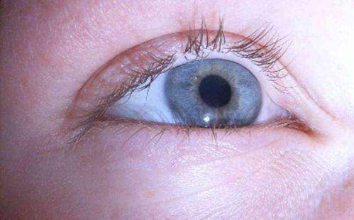 福鼎市医院眼科特色项目及技术优势