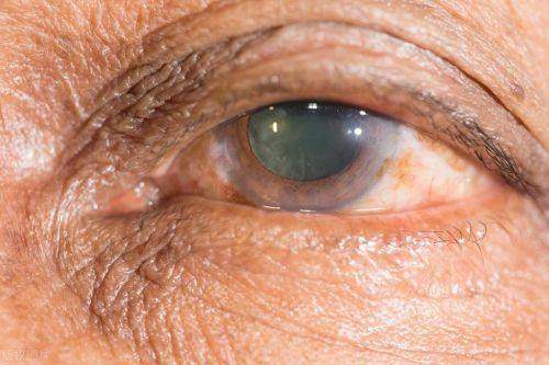 大连何氏眼科医院（普兰院）地址电话营业时间