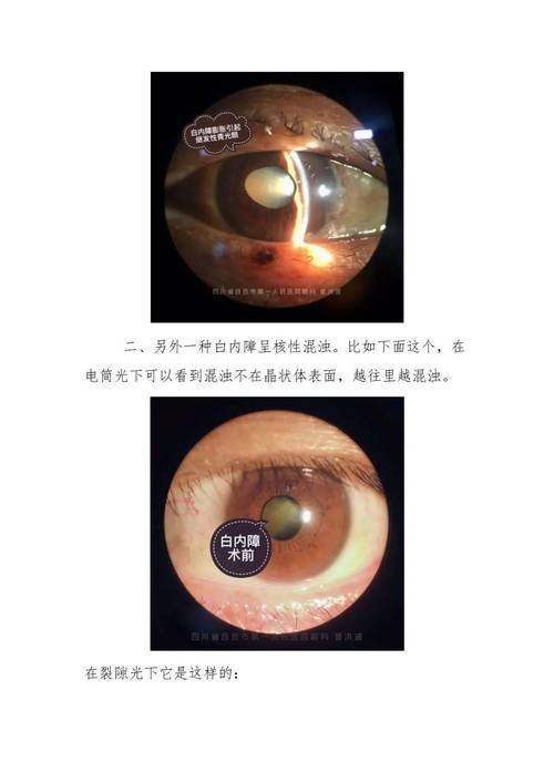 孝感市中 心医院眼科医生团队实力强大及骨干医生简介