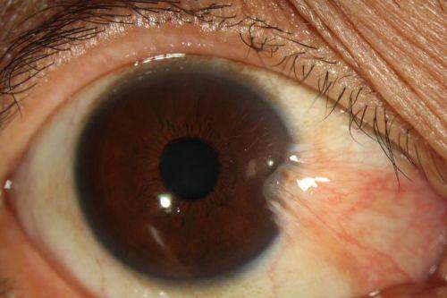 深圳大学总医院眼科门诊真人口碑评价怎么样?