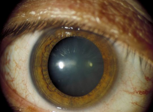 福鼎市医院眼科收费价格表/收费标准