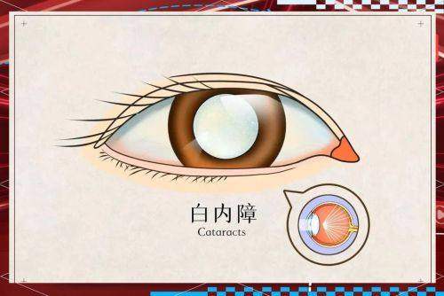 孝感市中 心医院眼科特色项目及技术优势