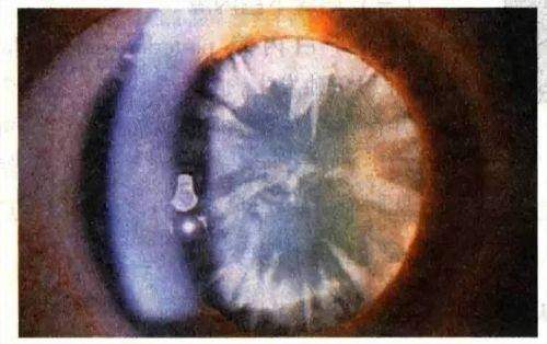 孝感市中 心医院眼科收费价格表/收费标准