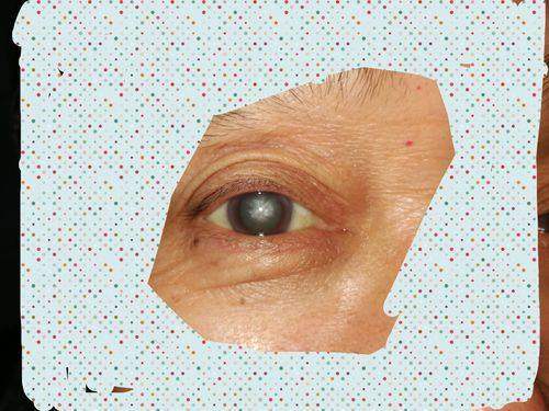 福鼎市医院眼科医生团队实力强大及骨干医生简介