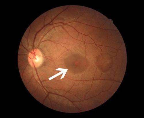 大连何氏眼科医院（普兰院）详细的预约挂号方式及流程