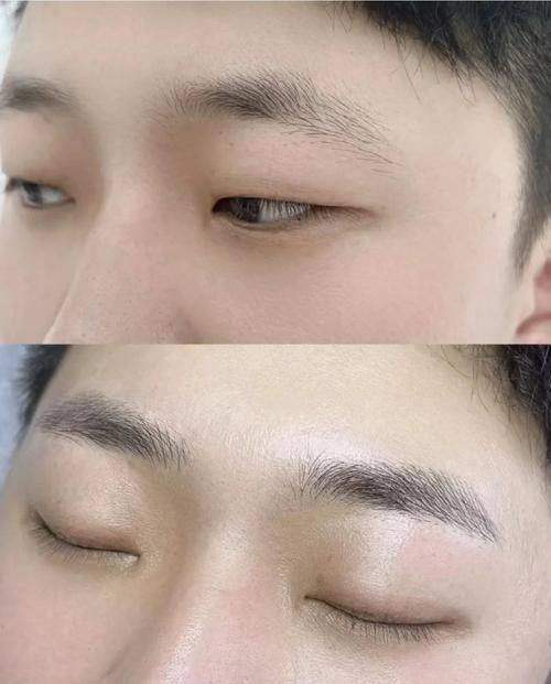 成都丝缘植发真人口碑评价怎么样？