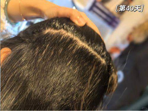 成都丝缘植发地址电话营业时间