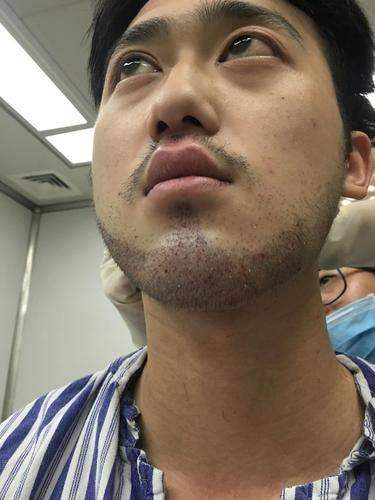 成都丝缘植发是正规医院吗？