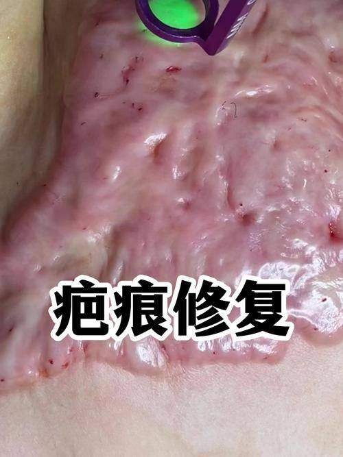 成都丝缘植发详细的预约挂号方式及流程