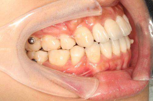 南昌辉煌口腔南京路分院整形科详细的预约挂号方式及流程