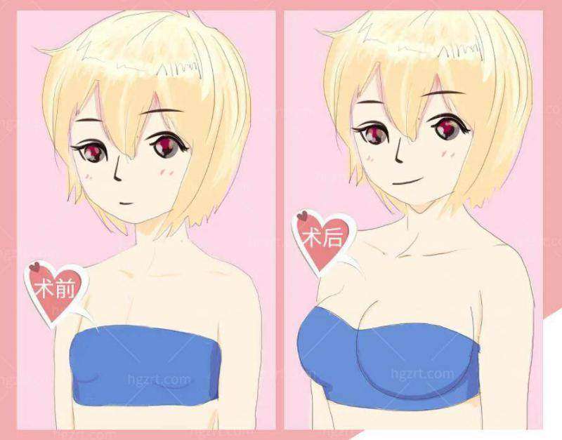 西安雁塔大爱黑金DPL超光子与M22黄金超光子对比