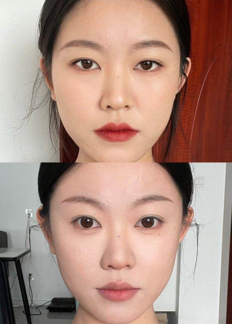 洪政槿医生擅长项目