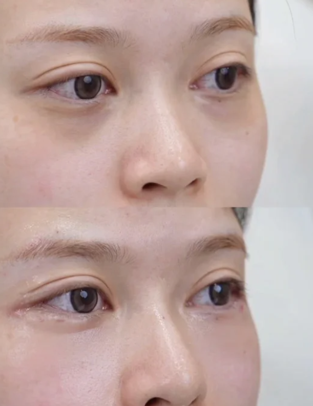 哈尔滨长峰血管瘤医院特色项目及技术优势