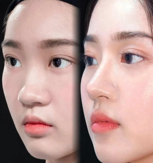 张文娴医生口碑评价及真人实例