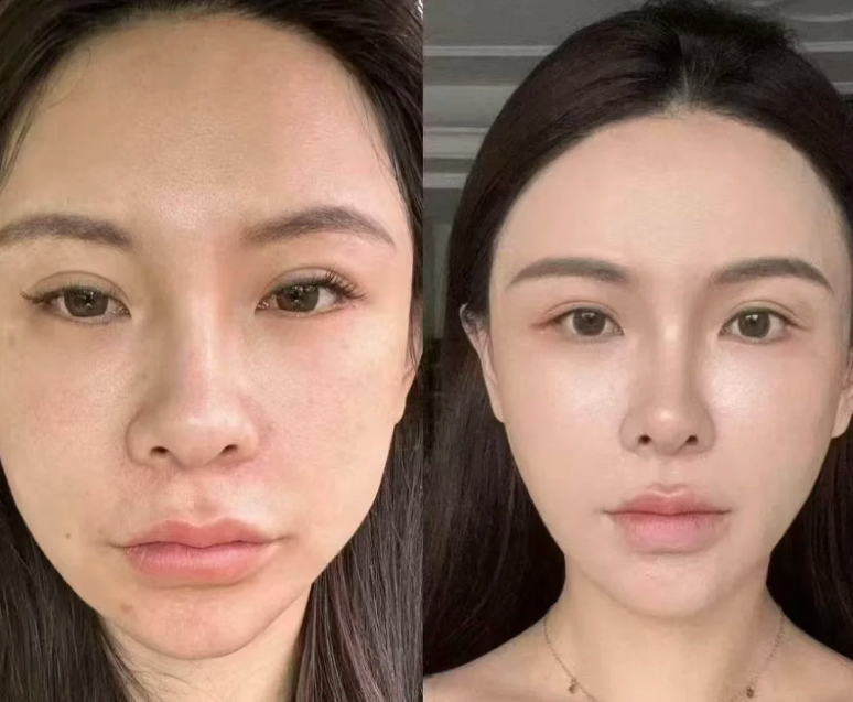 哈尔滨长峰血管瘤医院详细的预约挂号方式及流程