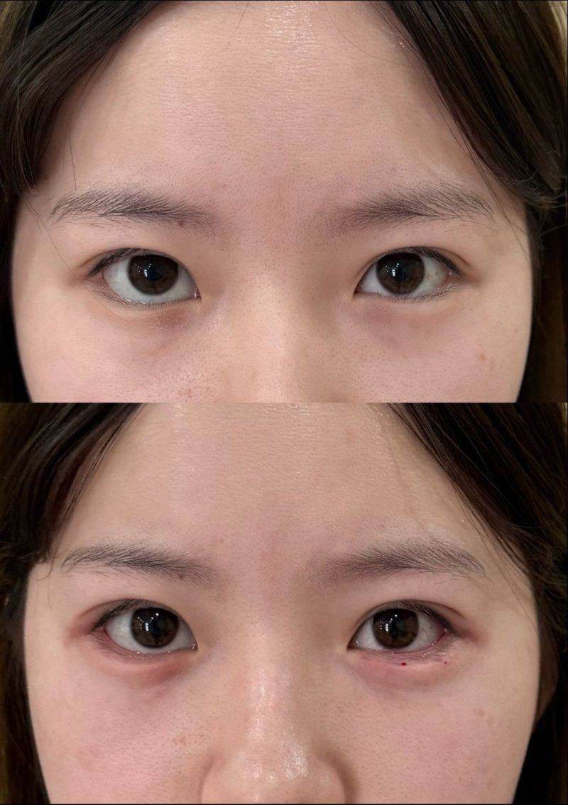 哈尔滨长峰血管瘤医院是正规医院吗？