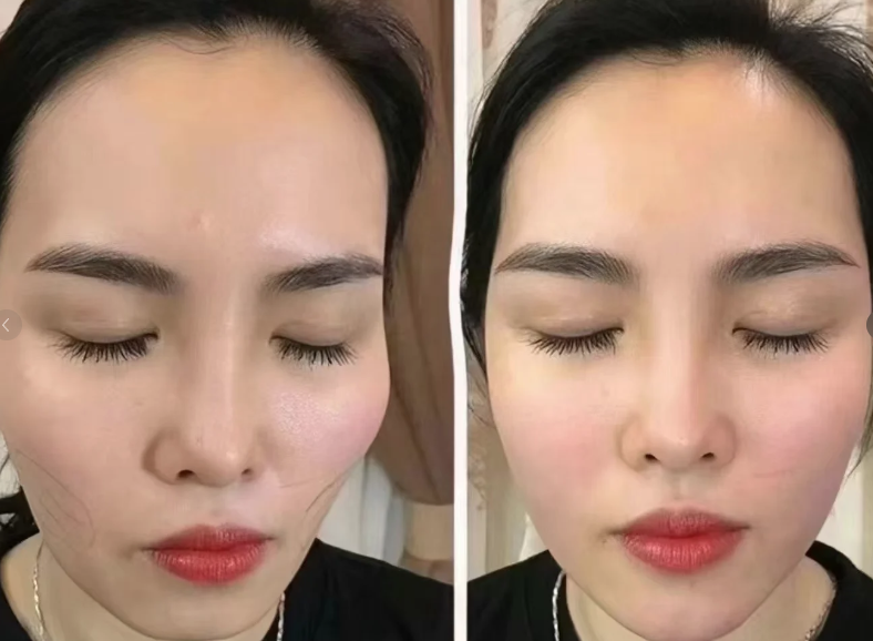 洪政槿医生口碑评价及真人实例