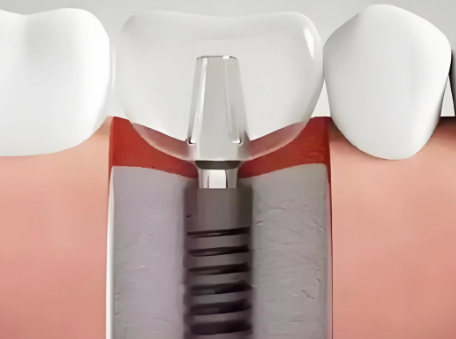 五、郑海鹏医生坐诊哪个医院？