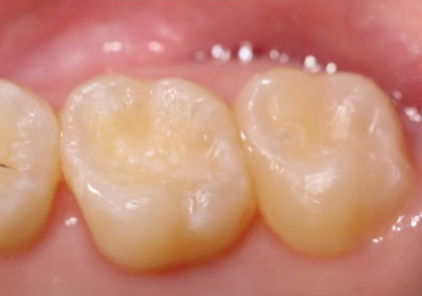 昆山亭林口腔门诊部收费价格表/收费标准