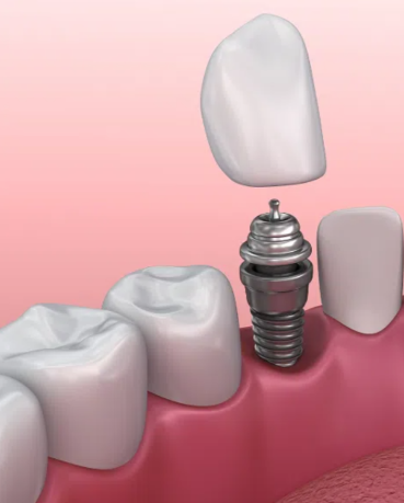 牛言海医生技术优势