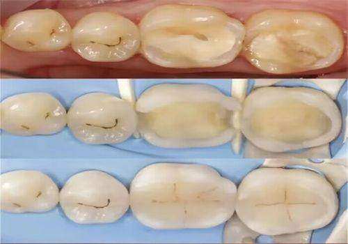 深圳南山明森口腔