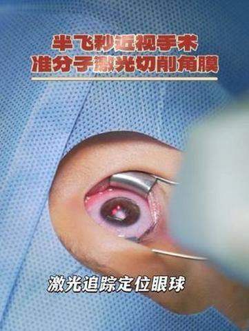 辽宁沈阳零度眼科真人口碑评价怎么样？